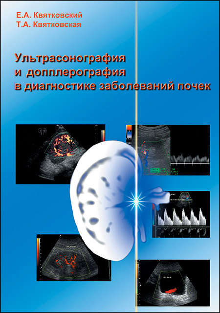 Ультрасонография и допплерография в диагностике заболеваний почек